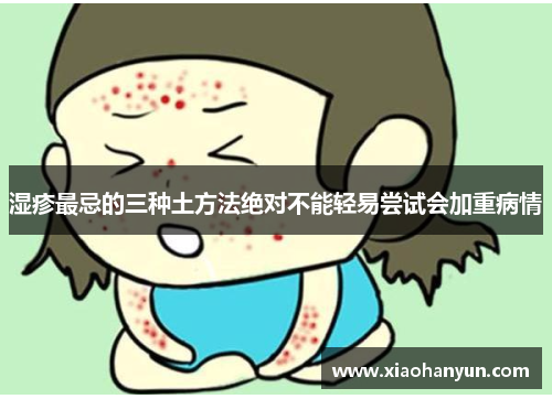 湿疹最忌的三种土方法绝对不能轻易尝试会加重病情